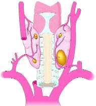 One adenoma and 3 normal parathyroids behind the normal thyroid.